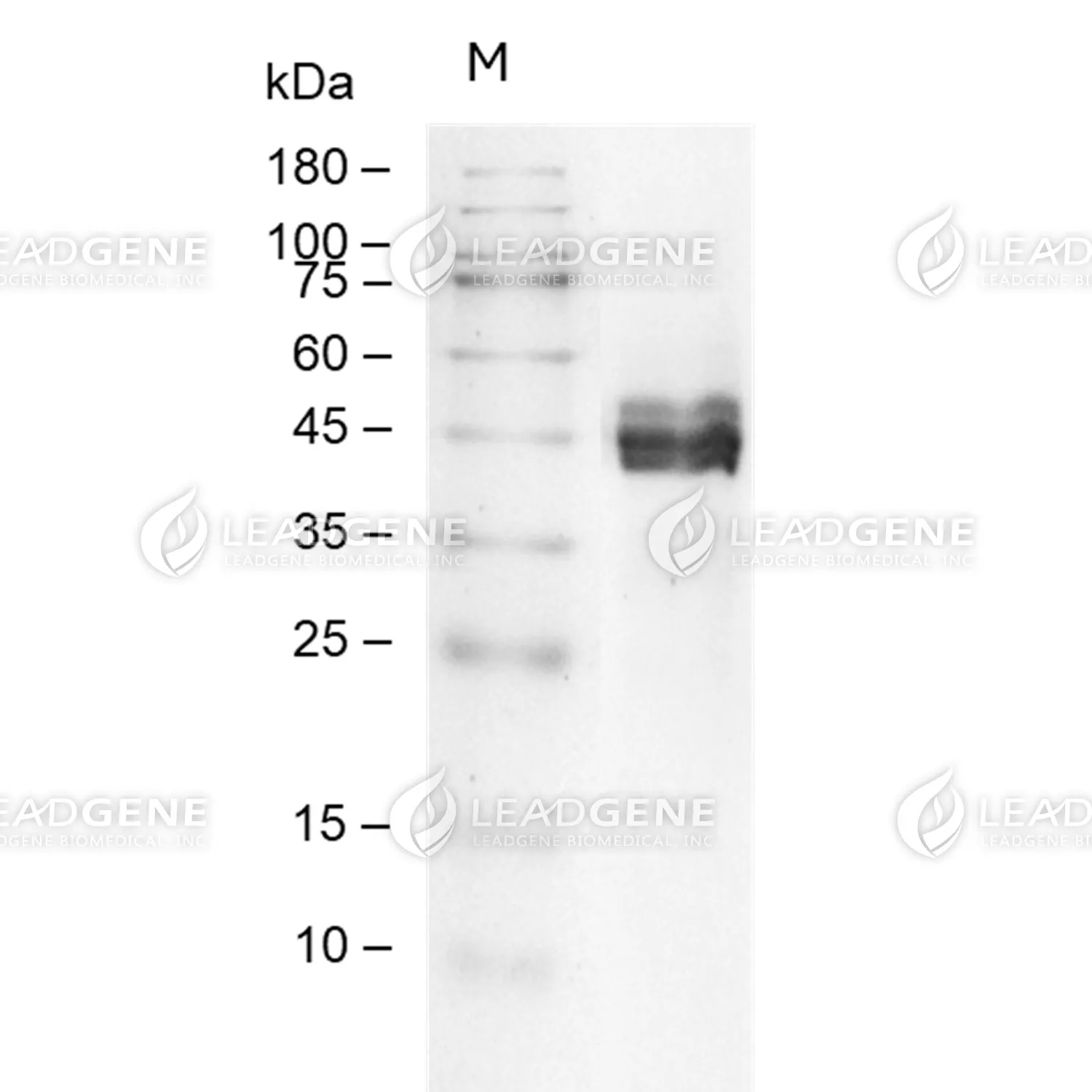 Human IL-11RA, His Tag, CHO
