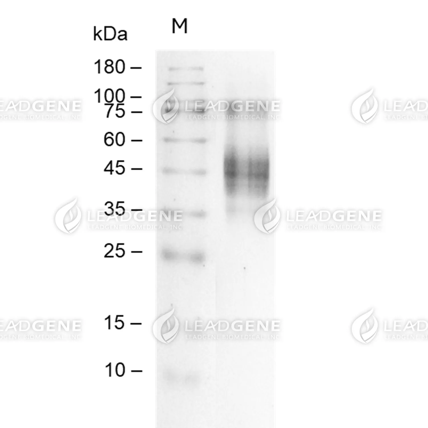 SDS-PAGE analysis of recombinant human FCGR1.