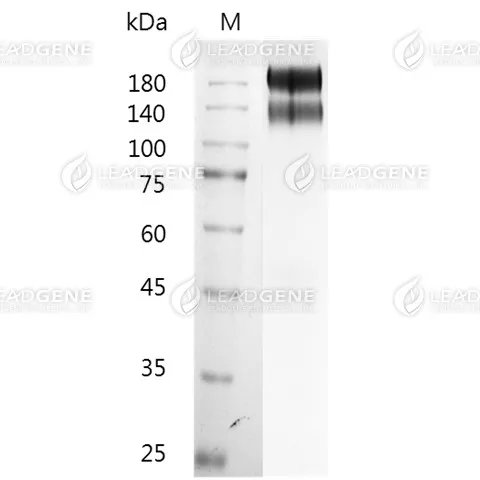 SDS-PAGE analysis of recombinant human IGF-1R.