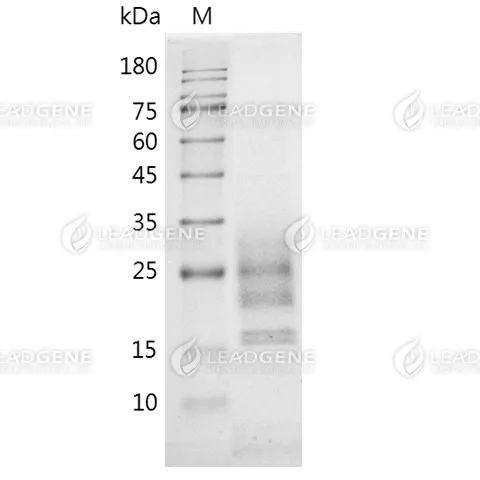 SDS-PAGE analysis of recombinant mouse DR5.