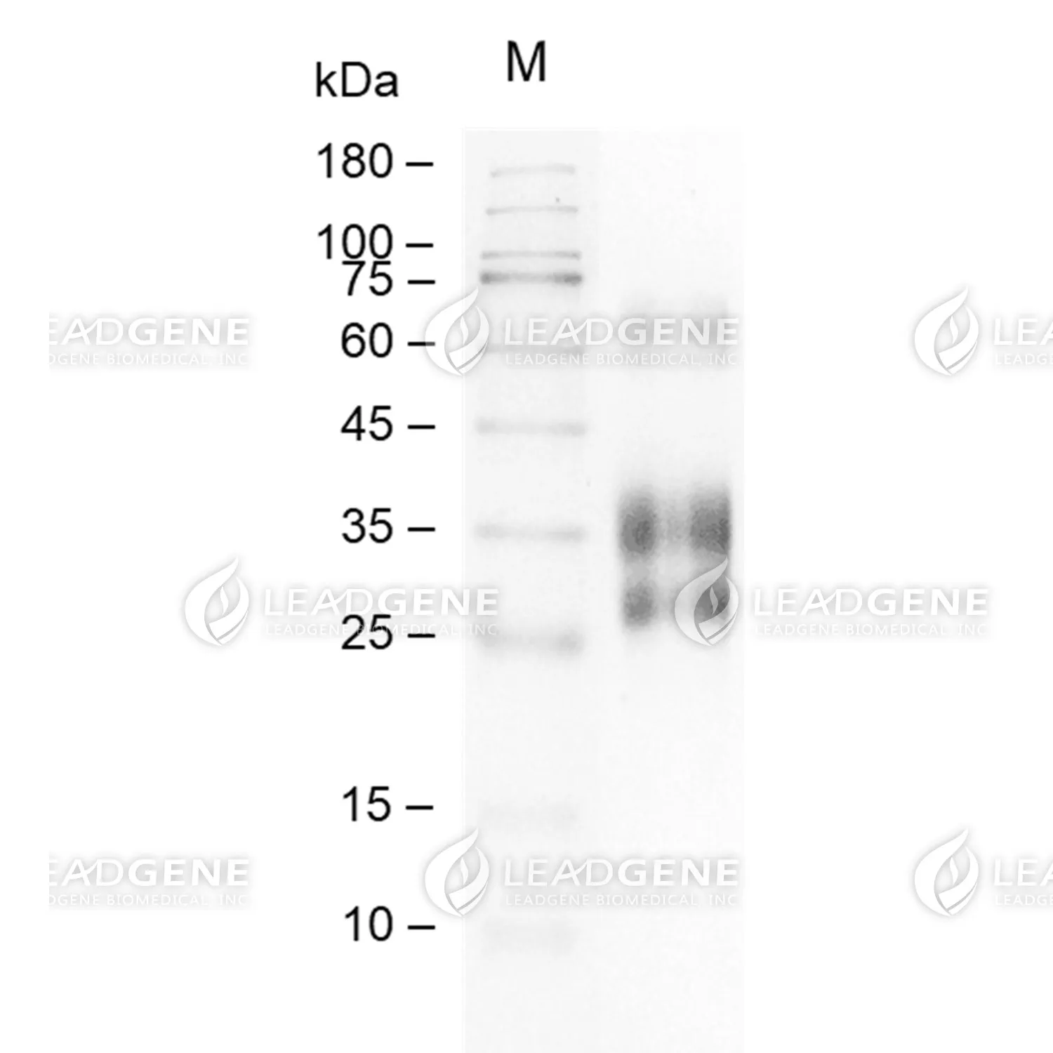 SDS-PAGE analysis of recombinant human CLEC2.
