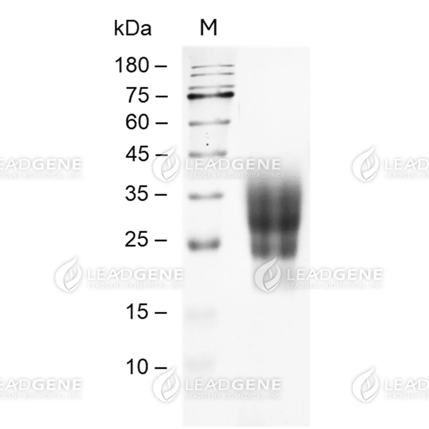 SDS-PAGE analysis of recombinant Human CD47 Protein.