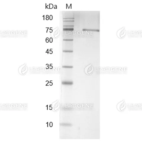 Human Complement C1s, His Tag, HEK293