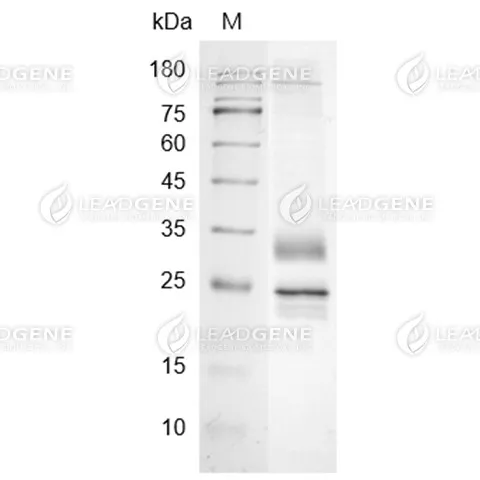 SDS-PAGE analysis of recombinant Mouse CD72.