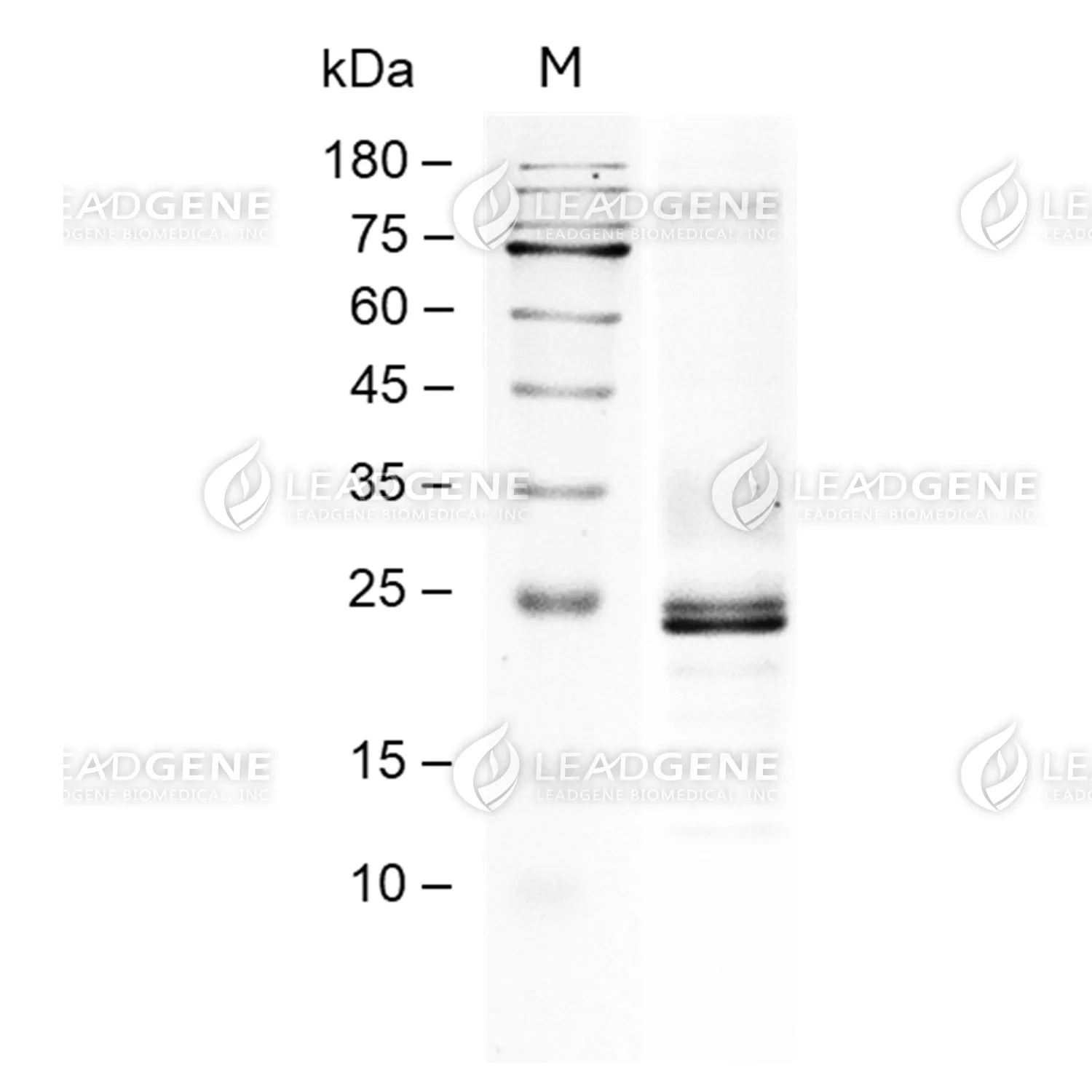 Human CD72, His Tag, CHO