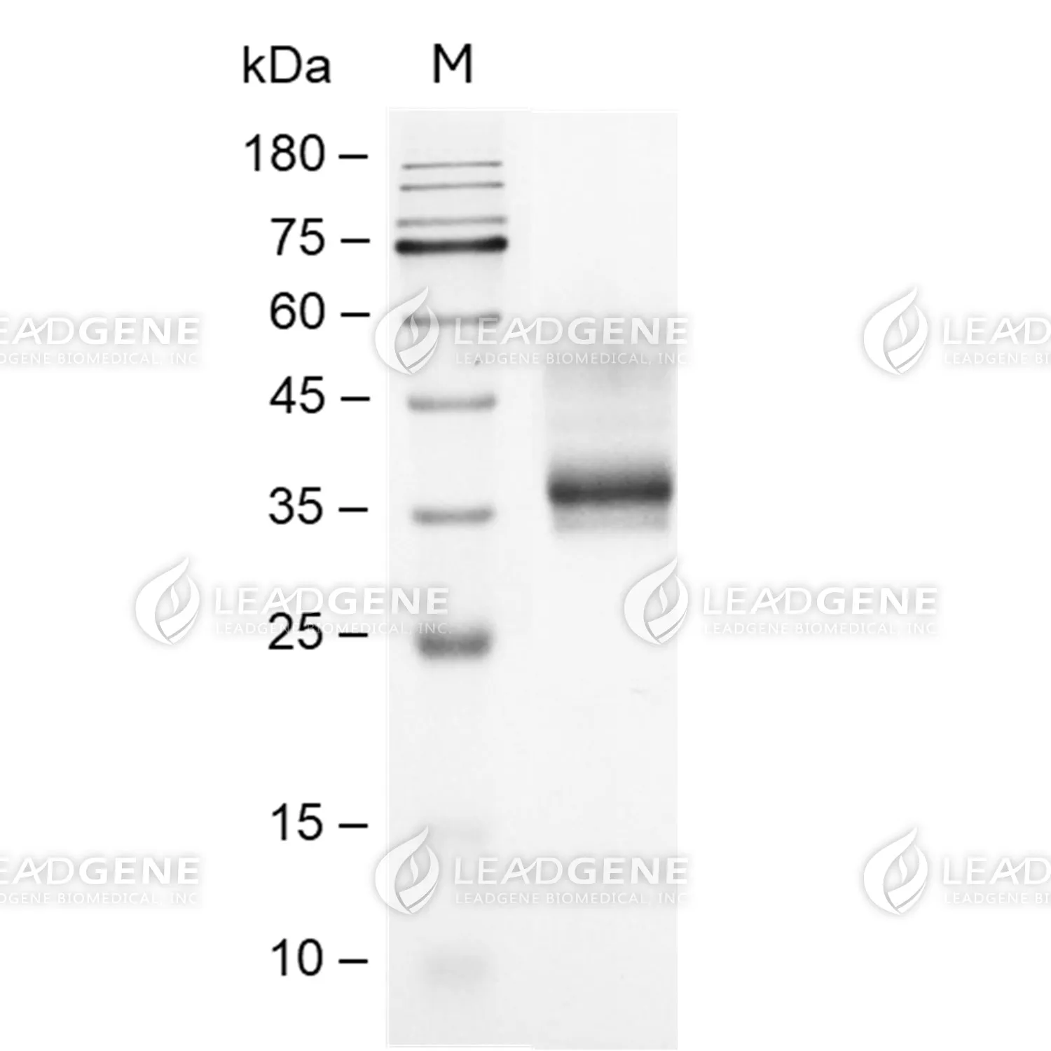 SDS-PAGE analysis of recombinant Mouse Complement C3b.