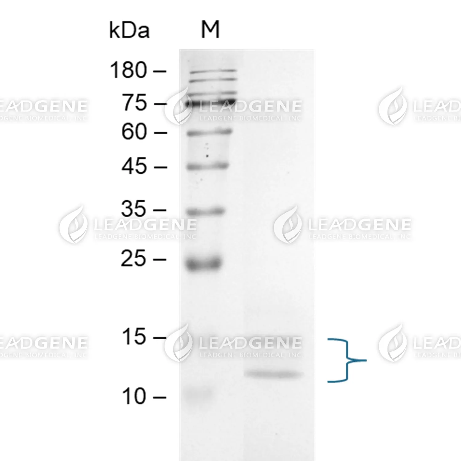 Human IL-11, His Tag, CHO