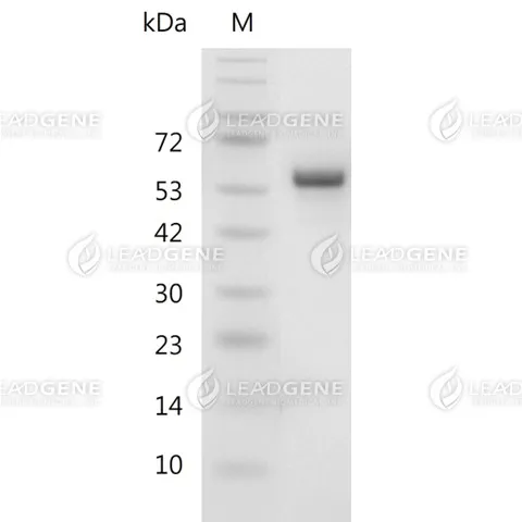 SDS-PAGE analysis of recombinant Human Noggin.