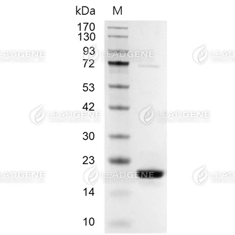 Human Myoglobin, His Tag, E. coli