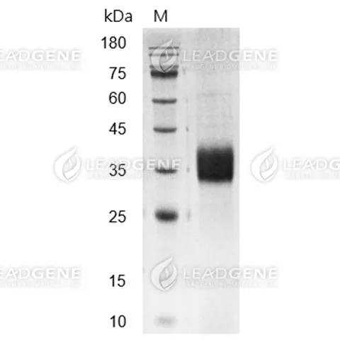 Human ASGPR1, His-Avi Tag, HEK293
