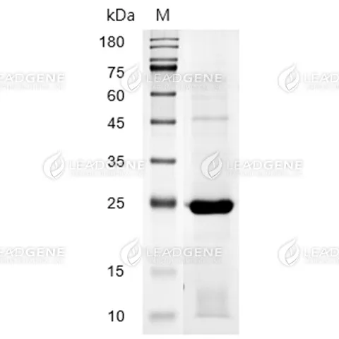 Human C-Reactive Protein, His Tag, CHO