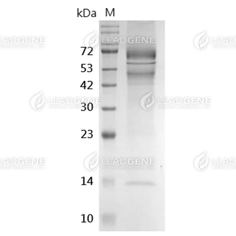 SARS-CoV-2 Nucleocapsid Protein (Omicron XEC Variant), His-SUMO Tag, HEK293