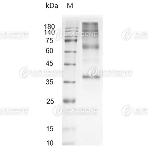 Human Glypican 3, His-Avi Tag, CHO