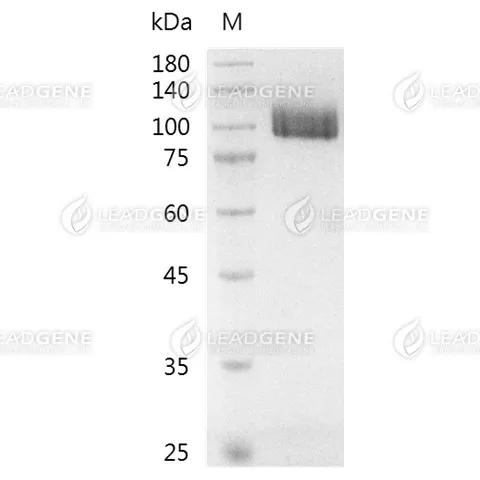 SDS-PAGE analysis of recombinant human CD22 protein.