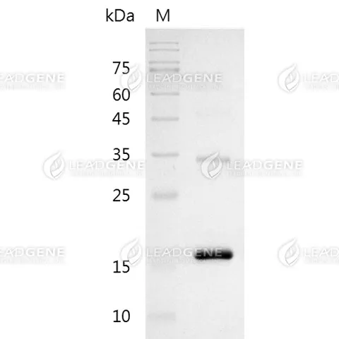 SDS-PAGE analysis of recombinant human lipoprotein(a) (KIV5-6) protein.