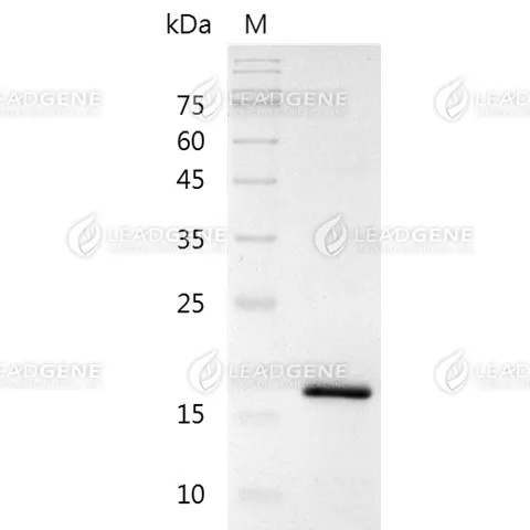 SDS-PAGE analysis of recombinant human lipoprotein(a) (KIV9-10) protein.
