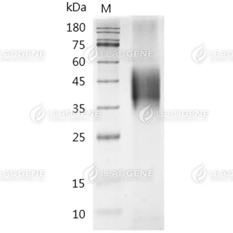 Mouse CD133, His Tag, HEK293