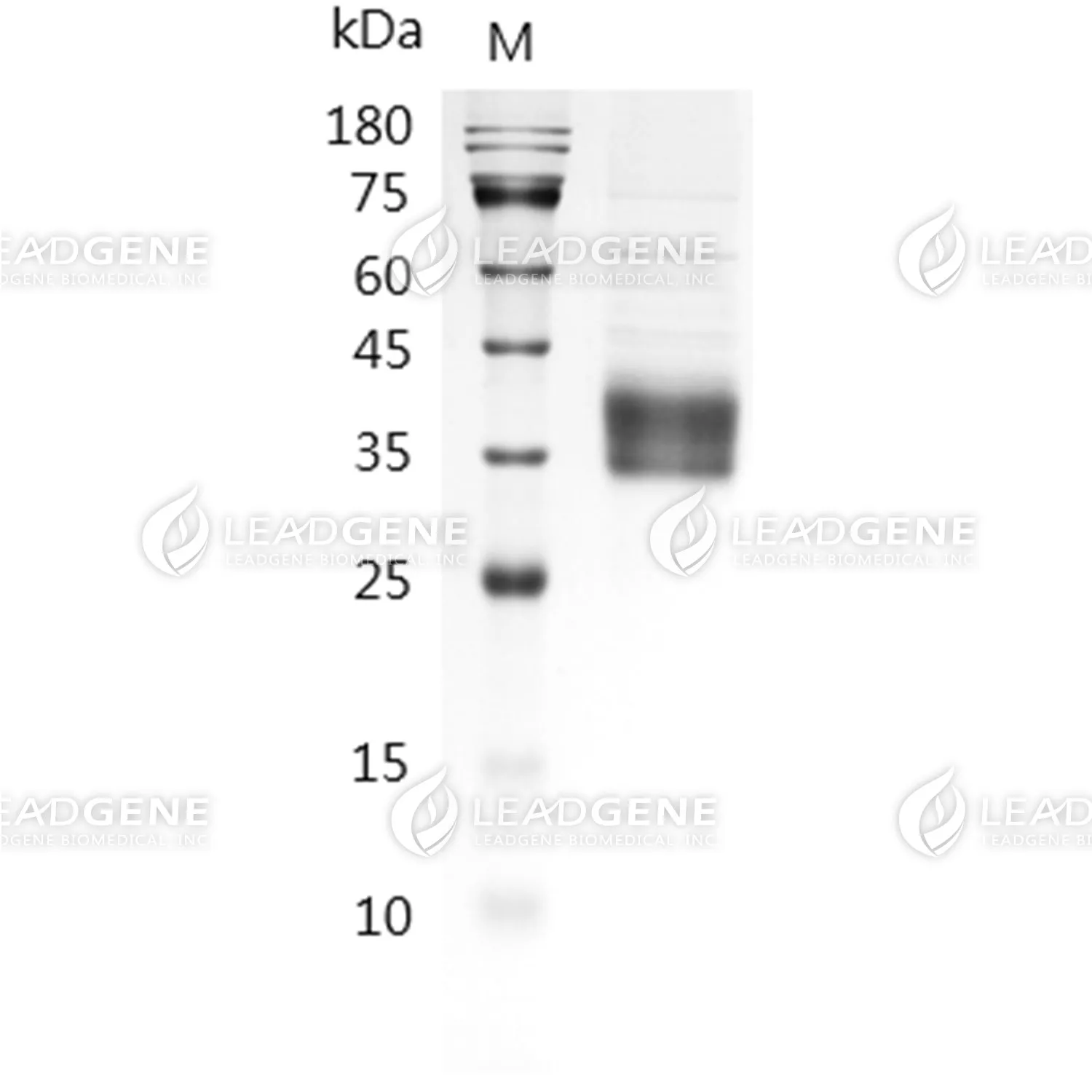Biotinylated Human ASGPR1, His-Avi Tag, HEK293
