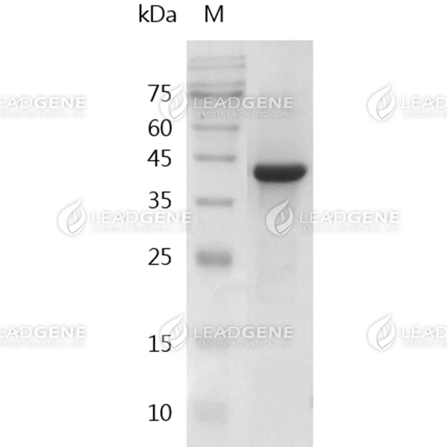 Mycoplasma Hyopneumoniae P46 Protein, His Tag, E. coli