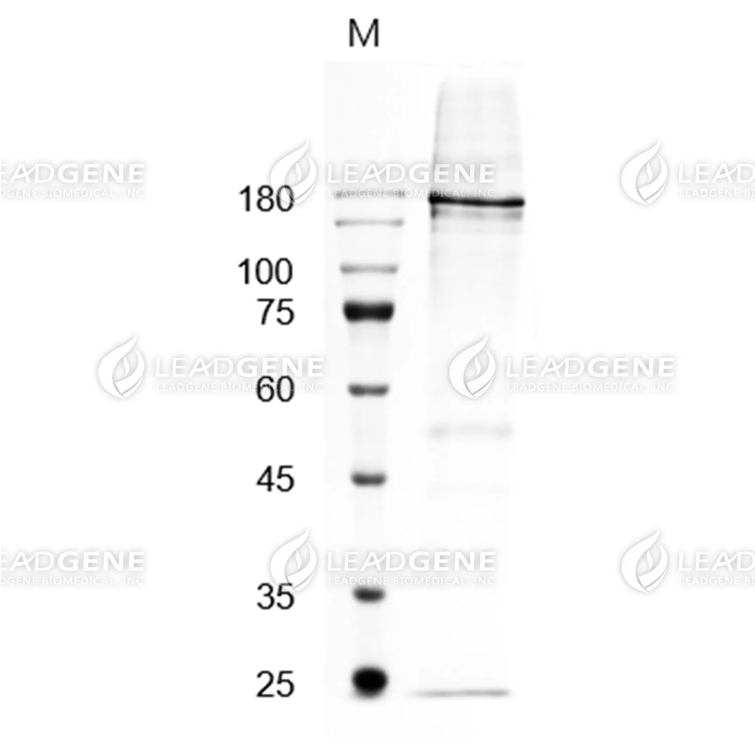 Human TSP1, His Tag, CHO