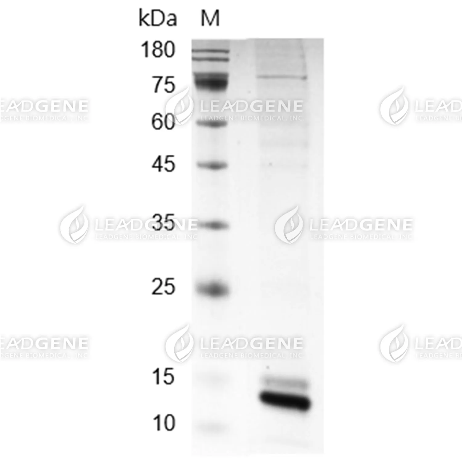 Biotinylated Human IL-2, His-Avi Tag, HEK293