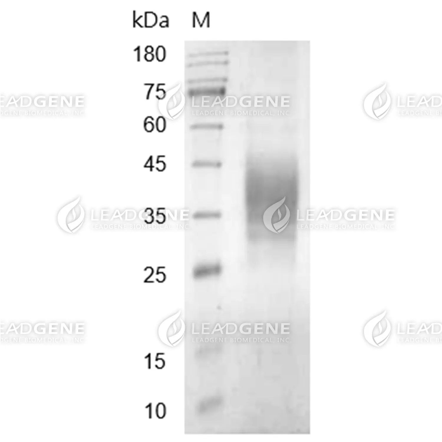 Biotinylated Human TRGC2, His-Avi Tag, HEK293