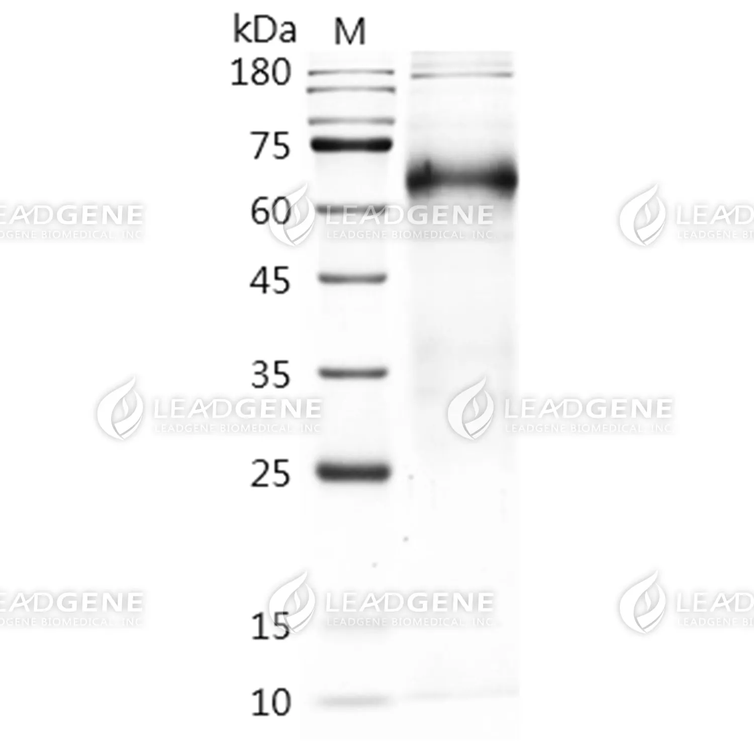 SDS-PAGE analysis of recombinant Human R-Spondin 3.