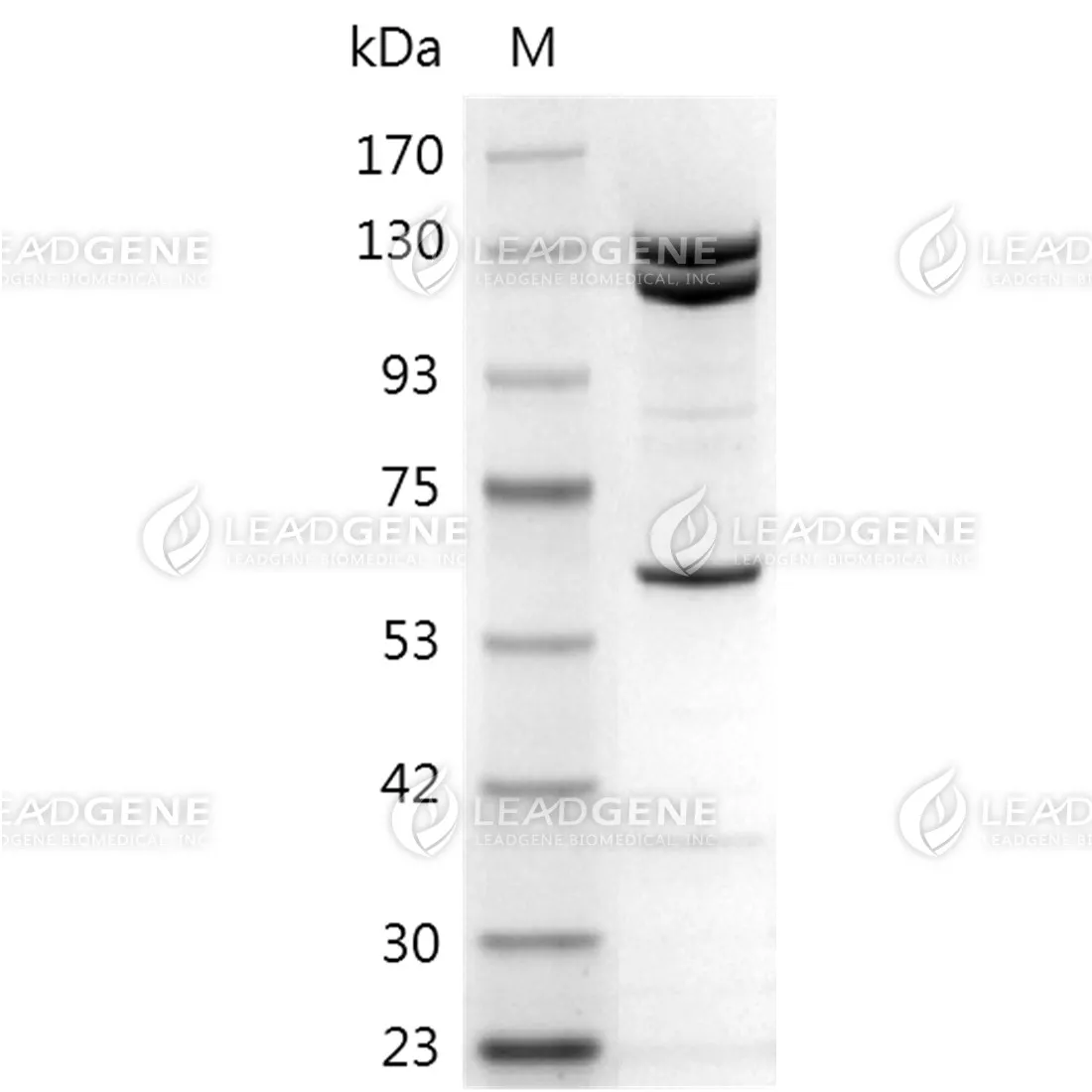 SDS-PAGE analysis of recombinant Exonuclease V (RecBCD).