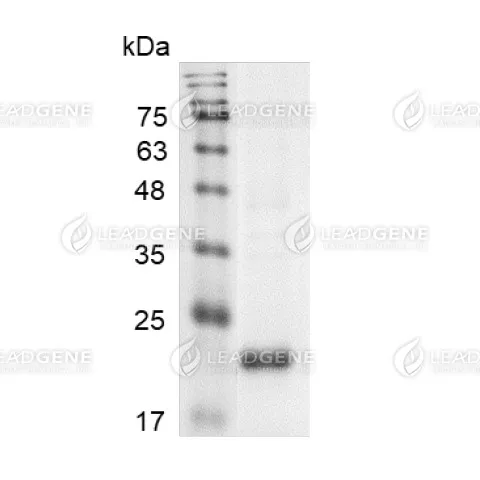 LeadGMP® Human IL-6 Protein, His Tag, E. coli