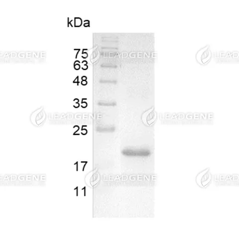 LeadGMP® Human IL-10 Protein, His Tag, E. coli