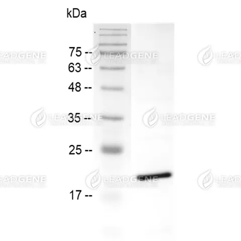 LeadGMP® Human 4-1BBL Protein, His Tag, E. coli