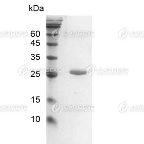 SDS-PAGE analysis of recombinant Endoglycosidase H