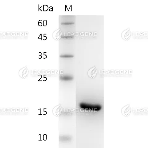 Human IL-1 Beta, His Tag, E. coli