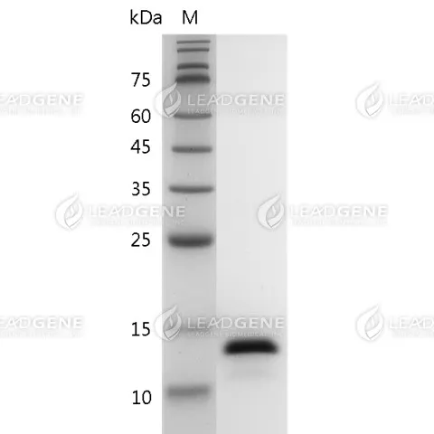 Human IL-2, His Tag, E. coli