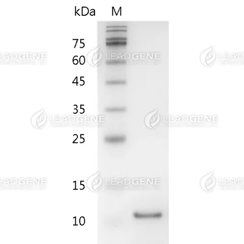 Human IL-5, His Tag, E. coli