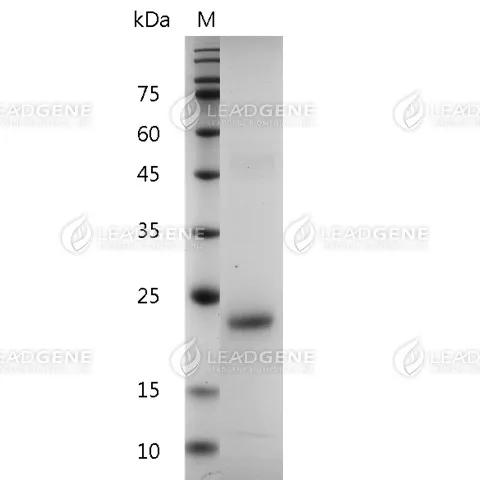 Human IL-6, His Tag, E. coli