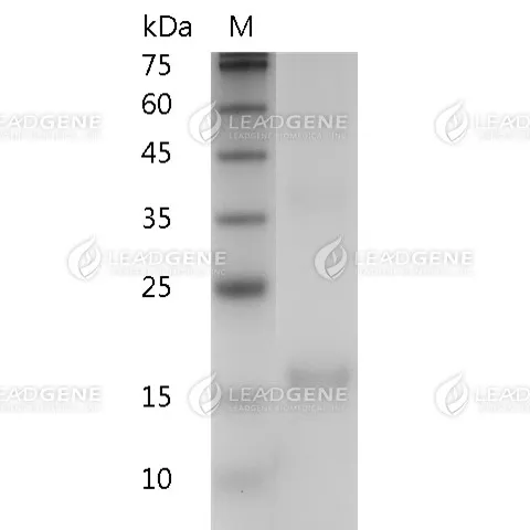 Human IL-7, His Tag, E. coli