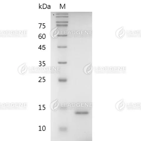 Human IL-9, His Tag, E. coli