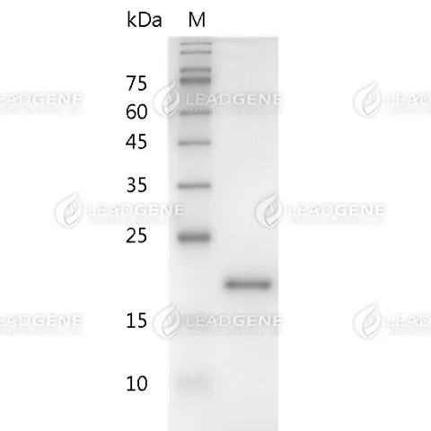 Human IL-10, His Tag, E. coli