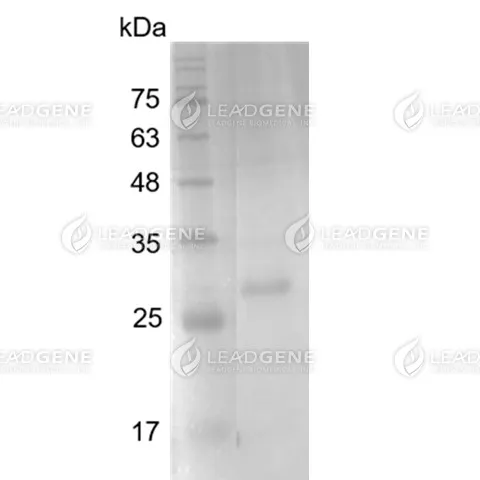 Human IL-12 (p35), His Tag, E. coli