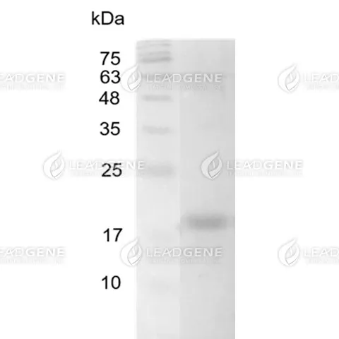 Human IL-16 (aa 2-130), His Tag, E. coli