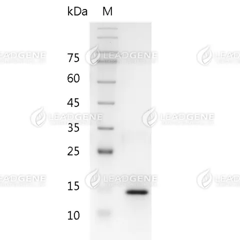 Human IL-17A, His Tag, E. coli