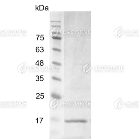 Human IL-17B, His Tag, E. coli