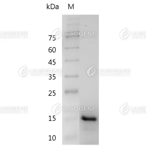 Human IL-17F, His Tag, E. coli