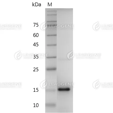 Human IL-20, His Tag, E. coli