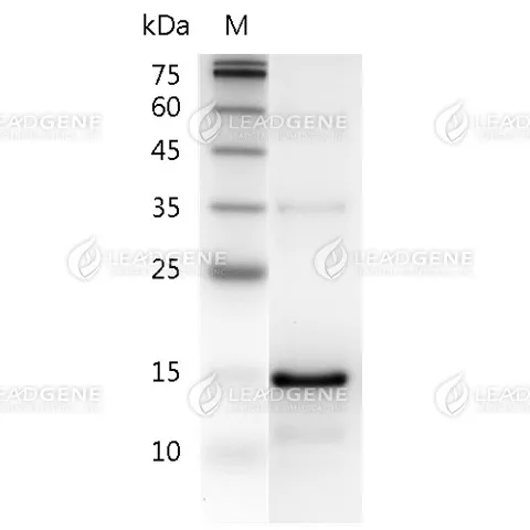 Human IL-21, His Tag, E. coli