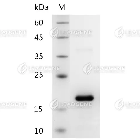 Human IL-25, His Tag, E. coli