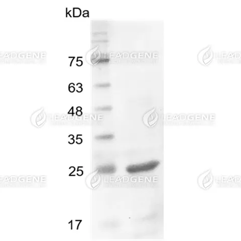 Human IL-27 (EBI3), His Tag, E. coli
