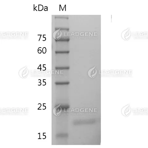 Human IL-28A, His Tag, E. coli