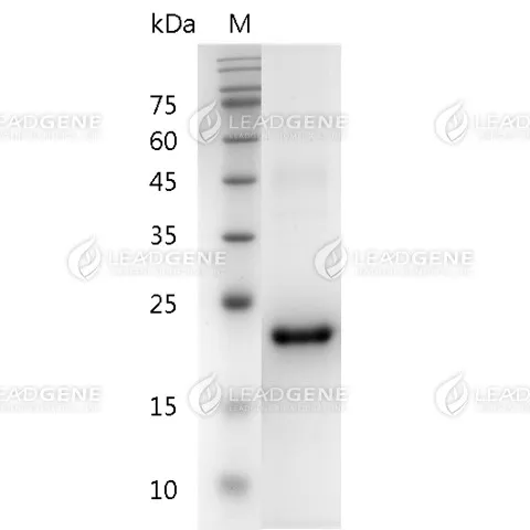Human IL-29, His Tag, E. coli